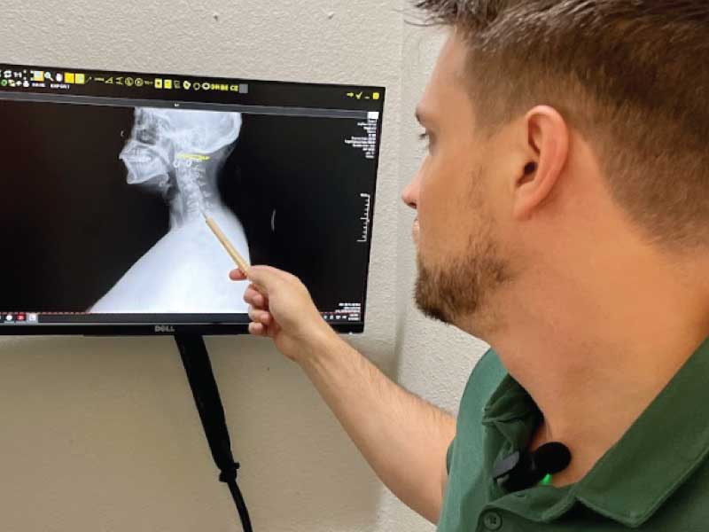 Dr chavez, d. C. , a chiropractor in lubbock, tx discusses x-ray results