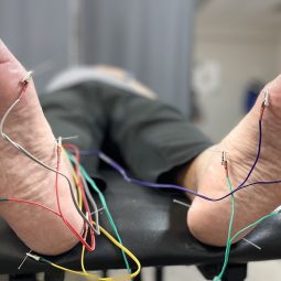 Dry needling in lubbock tx